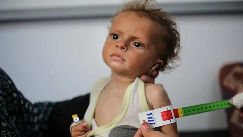 İngiltere, 300 Gazzeli Çocuğa Hayat Fırsatı Sunuyor