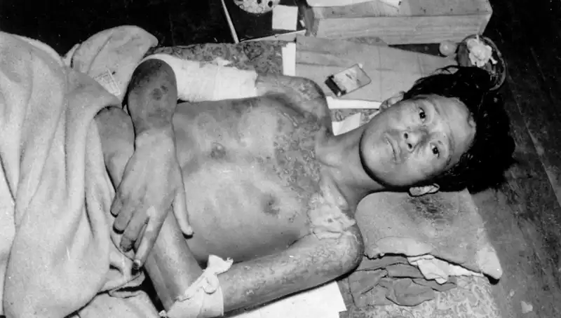 80 Yıl Sonra Nagasaki'den Çarpıcı Uyarı: Nükleer Felaketler Bizi Bekliyor