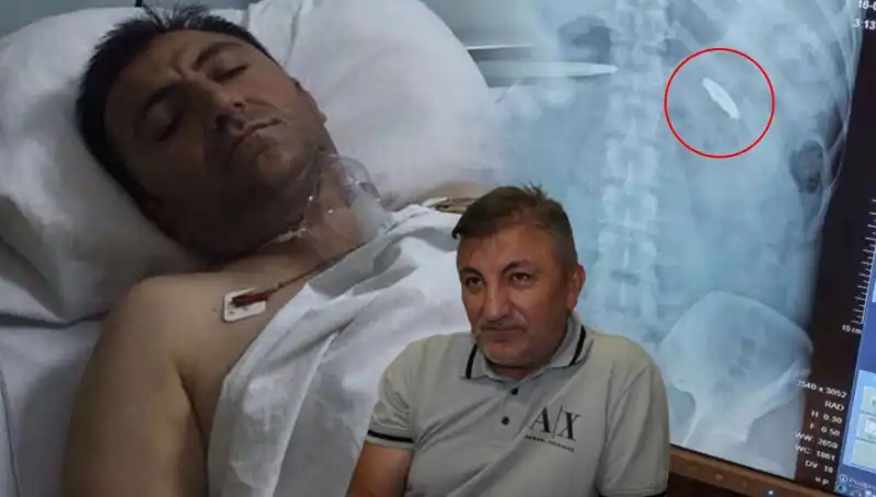 15 Temmuz’un Acı Kalıntıları: Vücudunda Kurşun Tutan Bir Hayat